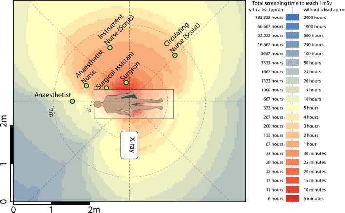 Plan-view heatmap of scattered-radiation exposure around the table during hip arthroplasty and hip arthroscopy.