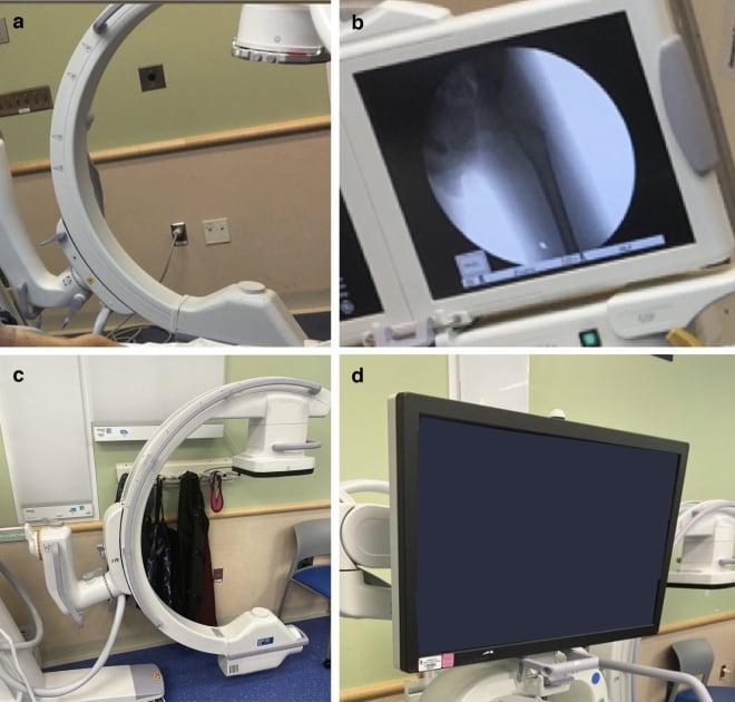 Photographs comparing mobile C-arms fitted with an image intensifier and a flat-panel detector, with their display systems.