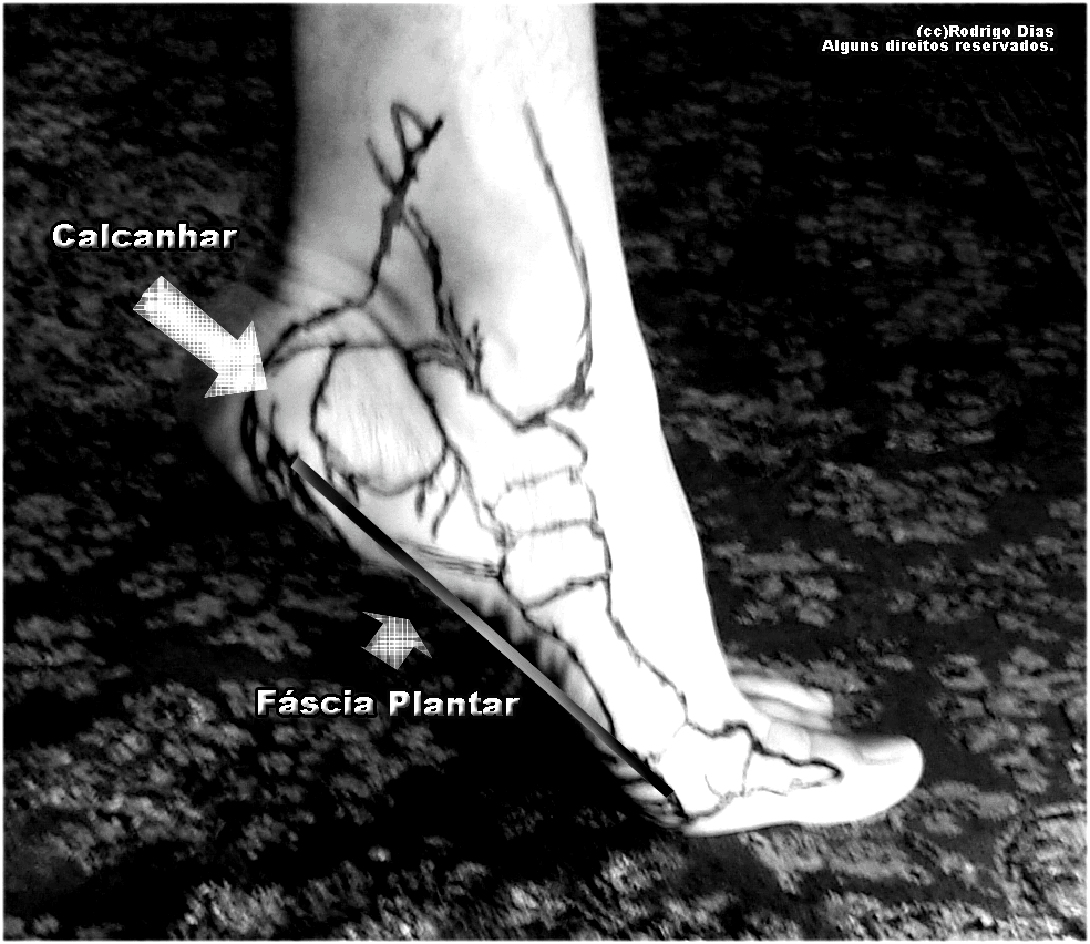 Lateral view of the plantar fascia along the longitudinal arch