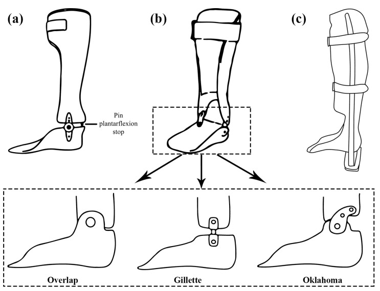 Diagram of a plantar-flexion-stop AFO, a hinged AFO and a patellar-tendon-bearing AFO with their ankle articulations