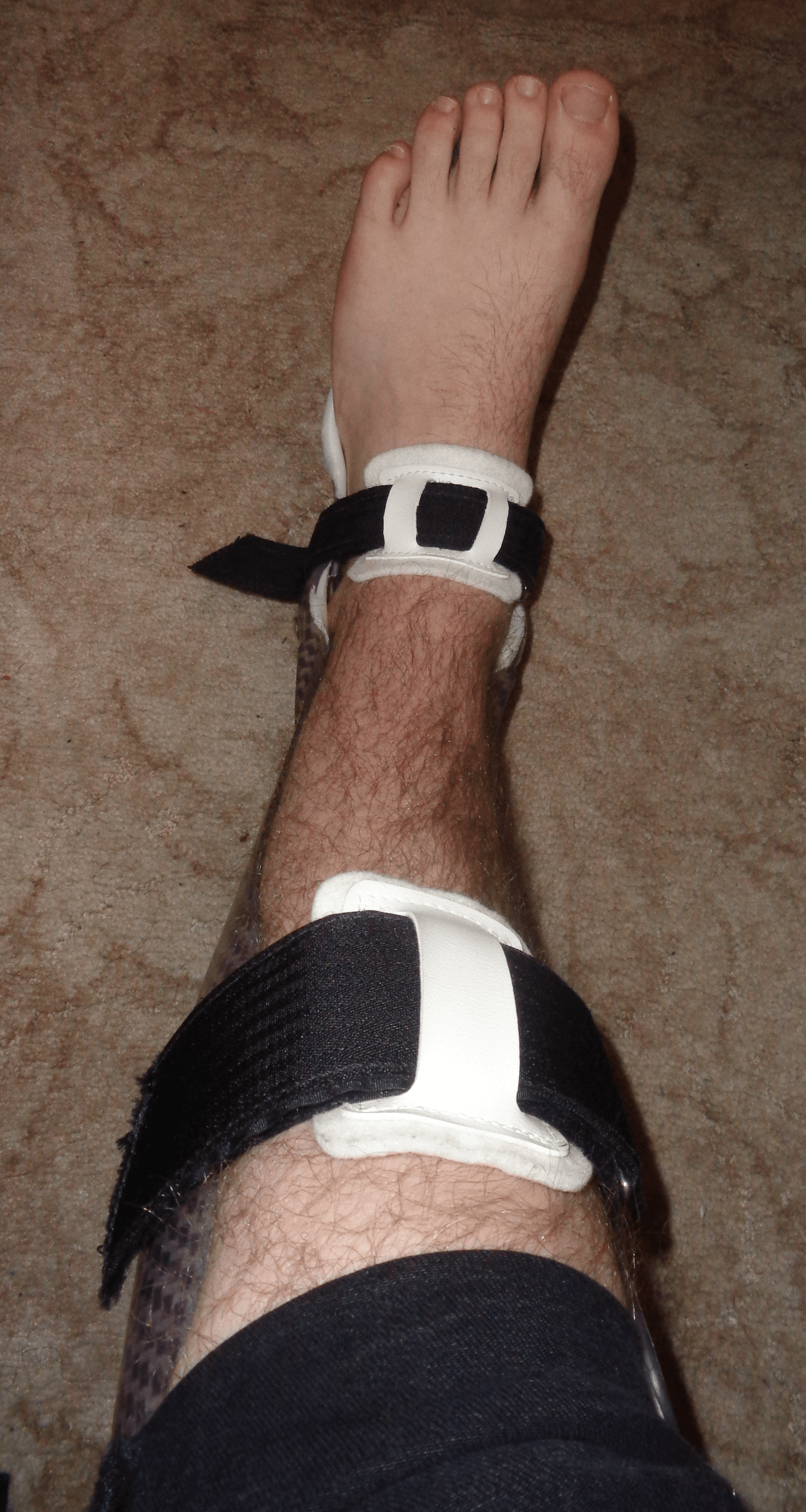 Photograph of a carbon-fibre energy-storing ankle-foot orthosis worn with a shoe