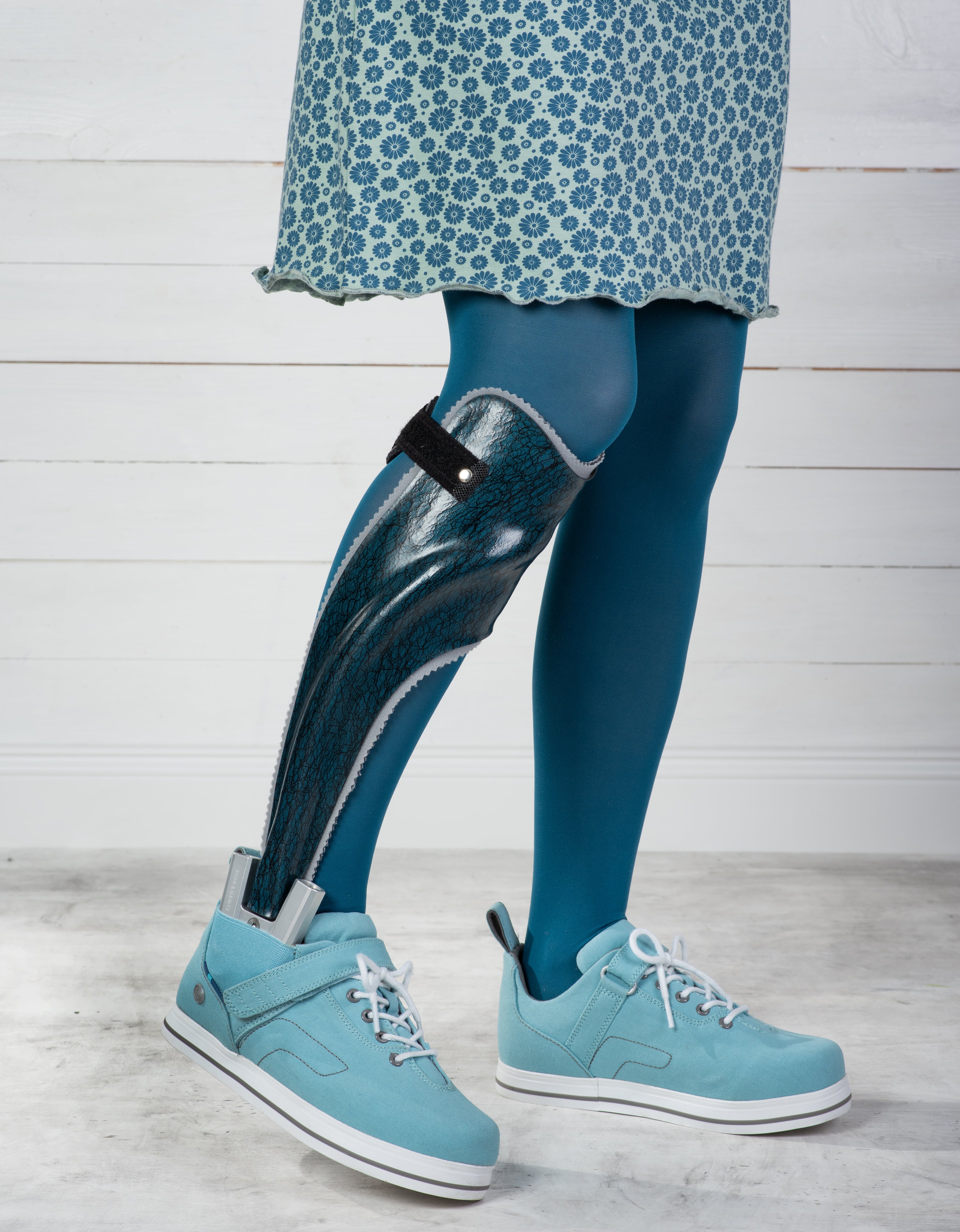 Lateral photograph of a leg wearing a carbon-fibre posterior-strut ankle-foot orthosis inside a shoe