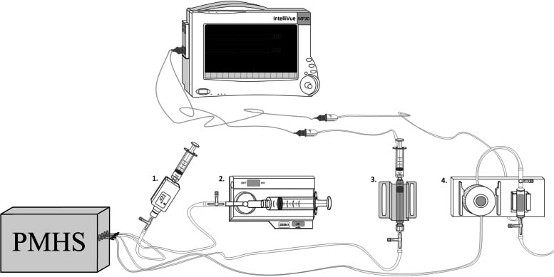Schematic of a cadaveric intracompartmental-pressure measurement setup