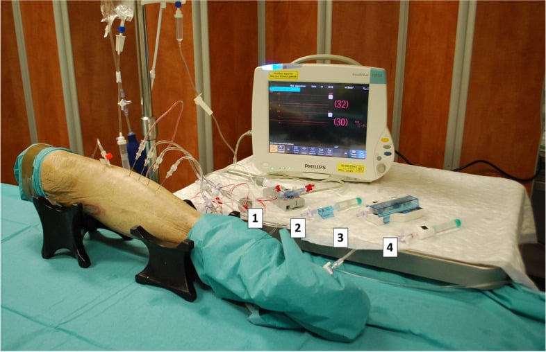 Cadaveric limb setup comparing devices for intracompartmental-pressure measurement