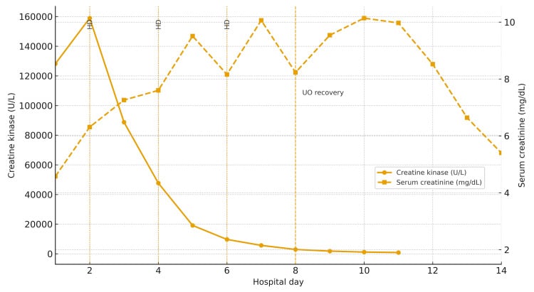 Graph showing creatine kinase and serum creatinine trends during severe rhabdomyolysis