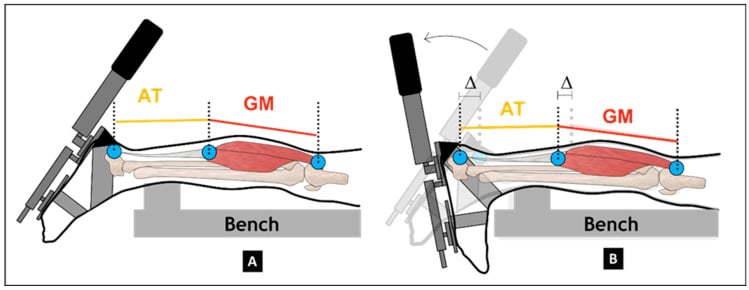 Bench diagrams showing dynamic measurement of gastrocnemius muscle-belly and Achilles-tendon length from plantarflexion to dorsiflexion.