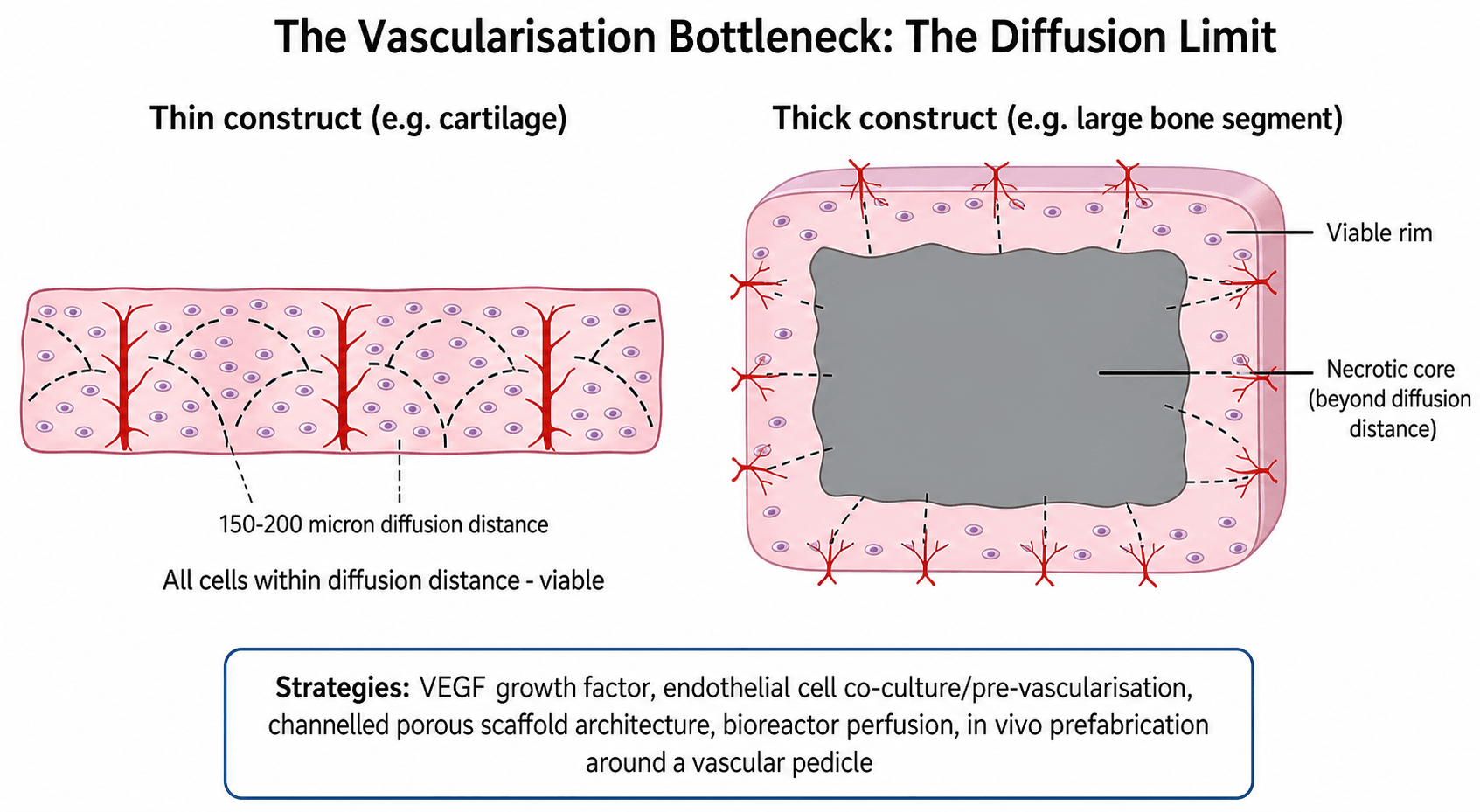 Diagram of the diffusion limit in tissue engineering: a thin construct like cartilage stays fully viable within 150-200 microns of a capillary, while a thick construct like a large bone segment develops a necrotic core beyond that distance