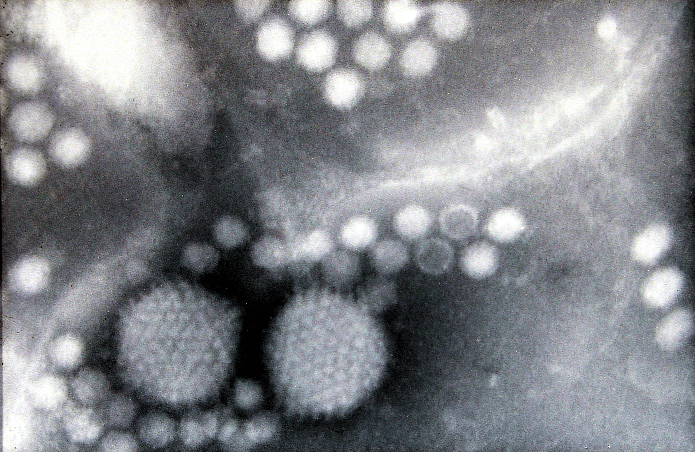 Electron micrograph of adeno-associated virus particles alongside two larger adenovirus particles