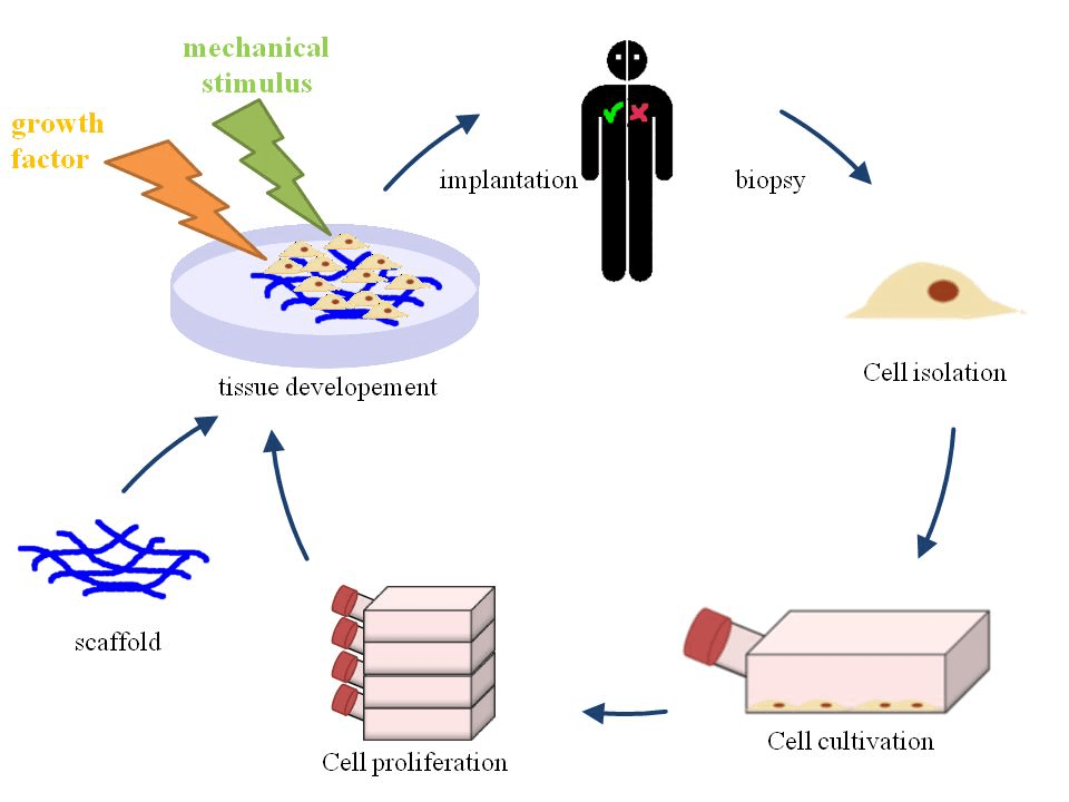 Diagram of the tissue-engineering workflow from biopsy through cell isolation, expansion and scaffold seeding to implantation
