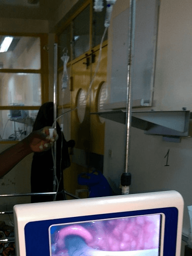 Clinical photograph of video laryngoscopy in use with the laryngeal view shown on a monitor