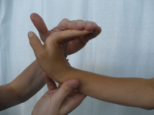 Hand with all four finger knuckle joints passively bent back until the fingers lie parallel to the back of the forearm.
