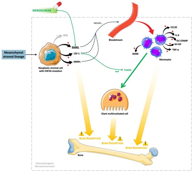 RANK-RANKL mechanism in giant cell tumour of bone and the site of denosumab action