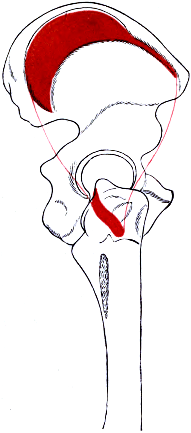 Line diagram of the right gluteus medius (red) and its bony attachments: the broad origin spreads across the gluteal surface of the ilium between the anterior and posterior gluteal lines, and the convergent tendon inserts on the lateral facet of the greater trochanter.