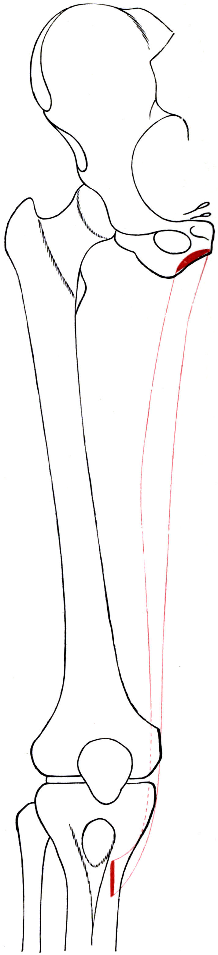 Diagram of the right femur, pelvis and tibia with the outline of gracilis and its attachment areas marked.