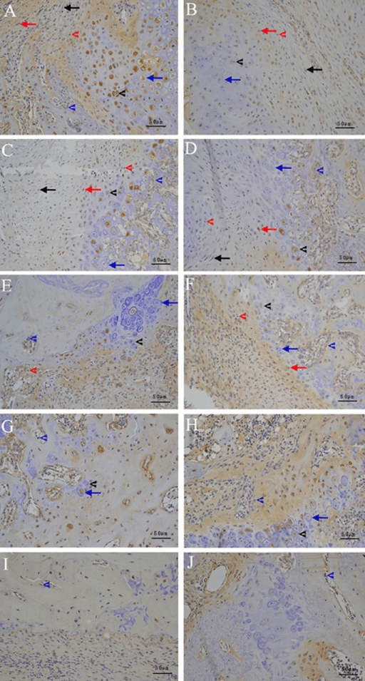 Multi-panel immunohistochemistry of fracture callus showing TGF-beta1 expression as brown DAB chromogen staining with blue haematoxylin counterstain, comparing control and diabetic groups across successive weeks of healing; arrows and arrowheads mark immunoreactive cells, with 50 micrometre scale bars.