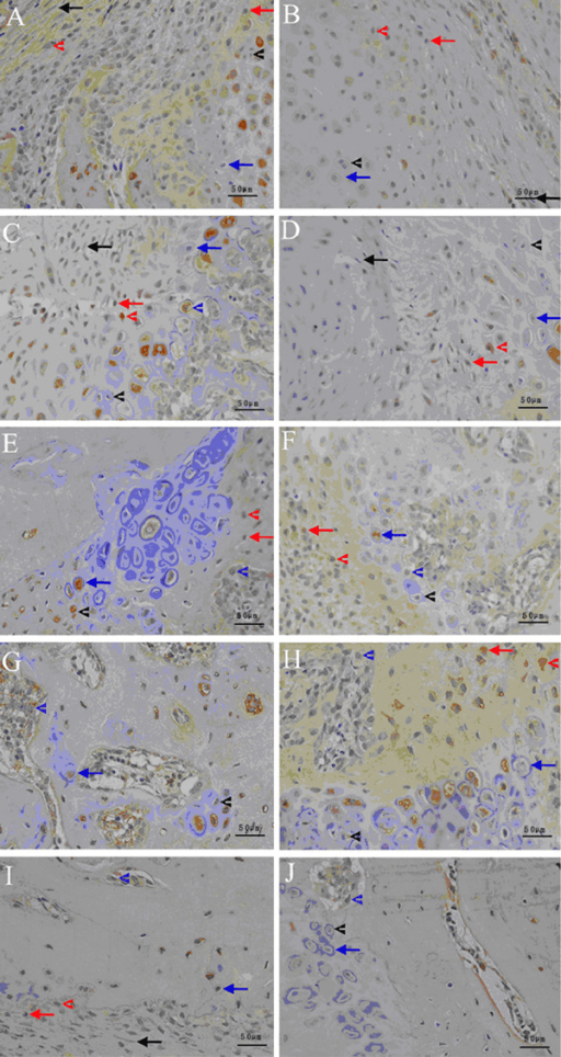 Multi-panel immunohistochemistry of fracture callus showing BMP-2 expression as brown DAB chromogen staining with blue haematoxylin counterstain, comparing control and diabetic groups across successive weeks of healing; arrows and arrowheads mark immunoreactive cells, with 50 micrometre scale bars.