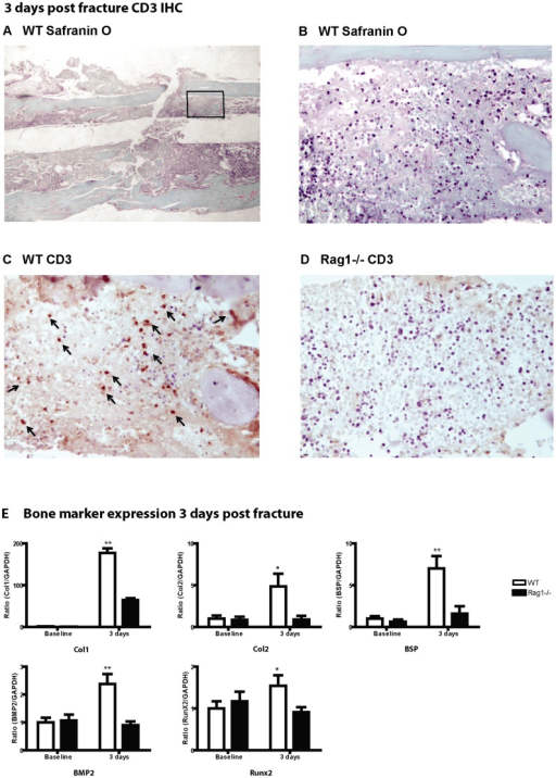 Three-day mouse fracture callus with CD3 immunostaining and bone-marker expression comparing wild-type and Rag1-knockout groups