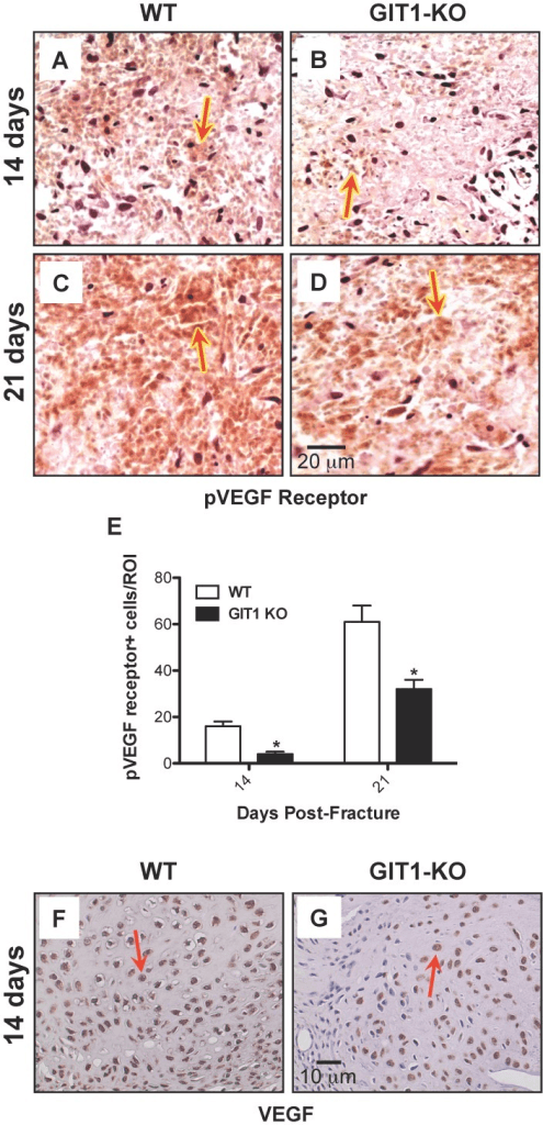pVEGF-receptor and VEGF immunostaining comparing wild-type and GIT1-knockout fracture callus at 14 and 21 days