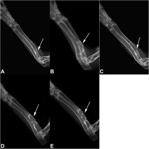 Twelve-week rabbit radial bone-defect radiographs comparing BMP2 and HIF1alpha carrier treatment groups