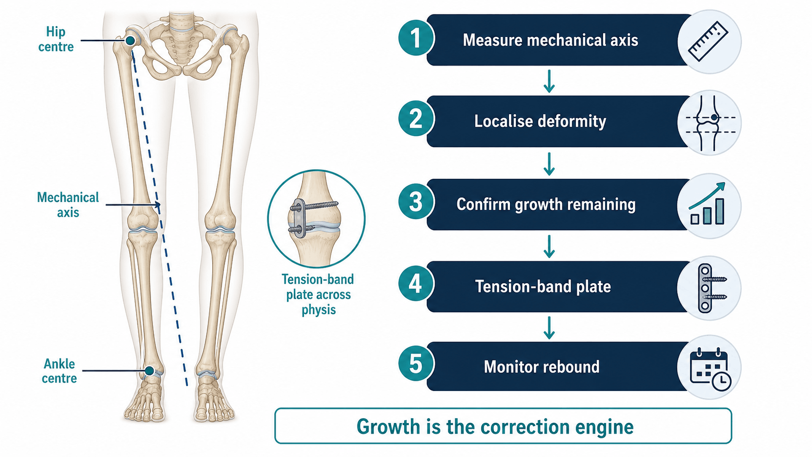 Guided growth decision pathway showing mechanical axis measurement, deformity localisation, growth remaining, tension-band plate and rebound monitoring