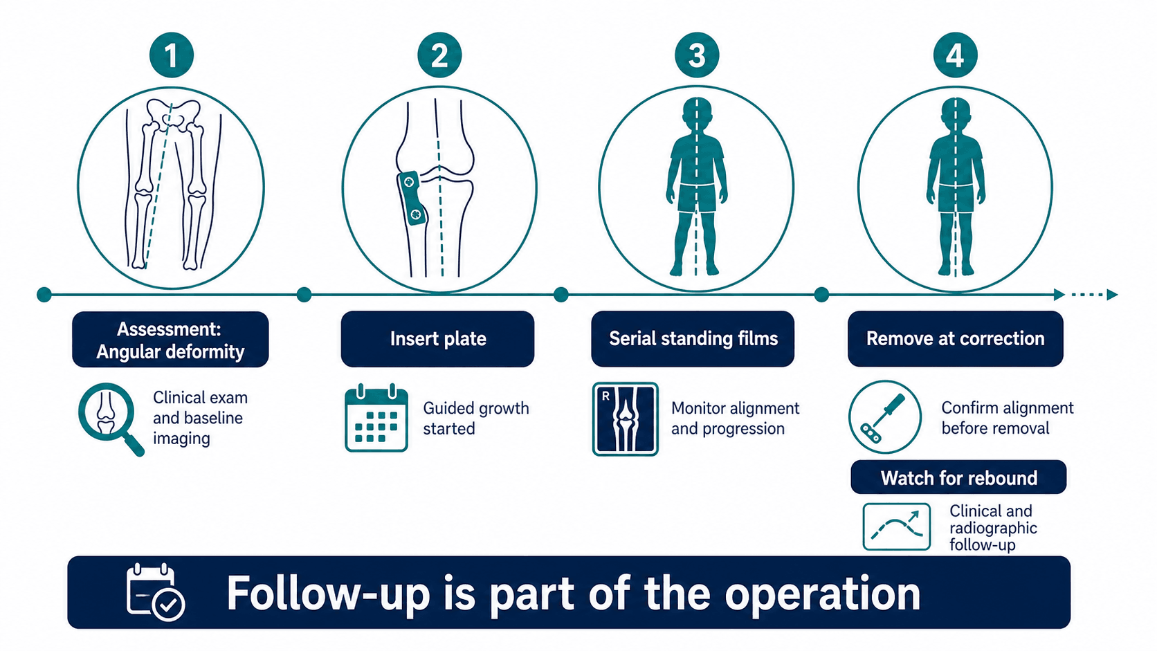 Guided growth complication prevention timeline showing plate insertion, serial standing films, plate removal at correction and rebound monitoring