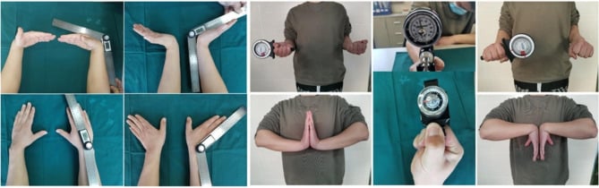 Wrist range-of-motion photographs, some with a goniometer, and dynamometer grip-strength testing after hook-of-hamate fixation