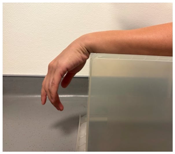 High-resolution ultrasound examination of hand flexor tendons