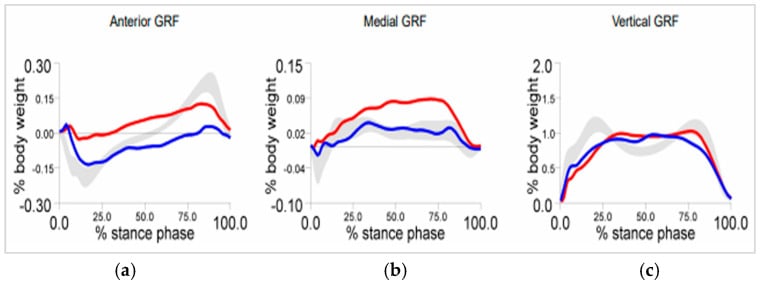 Ground reaction force vector curves during the gait cycle in Hereditary Spastic Paraplegia
