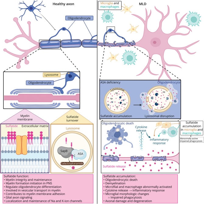 Arylsulfatase A enzyme activity and sulfatide excretion pathways in MLD