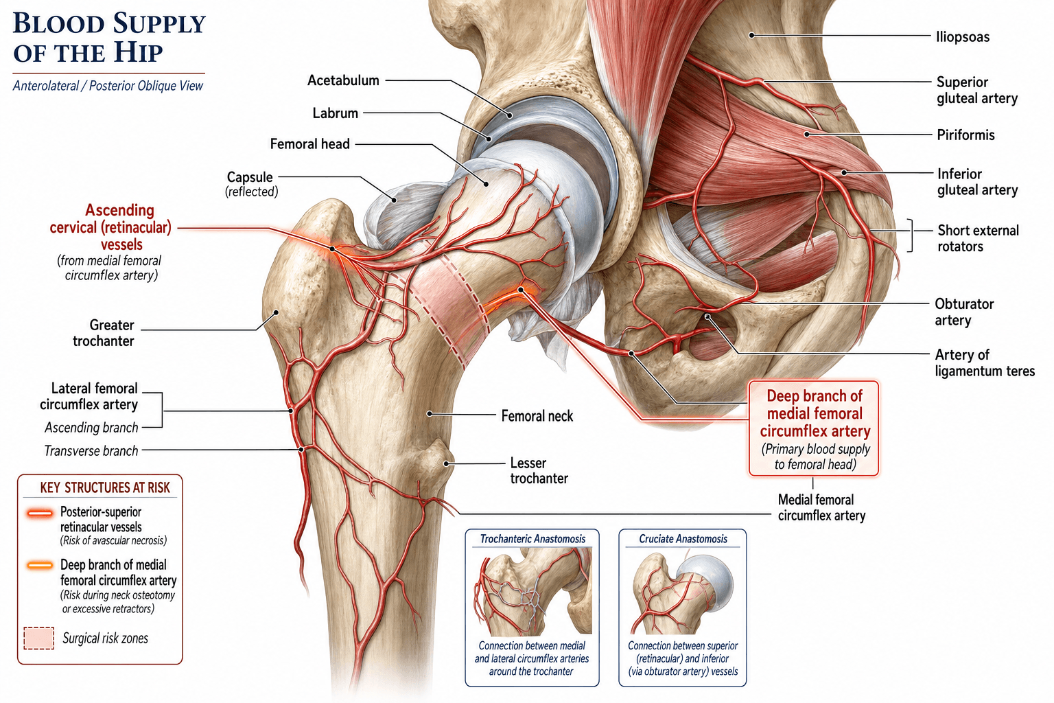 Surgical anatomy diagram of the femoral head blood supply guiding safe hip approaches and the surgical-dislocation technique.