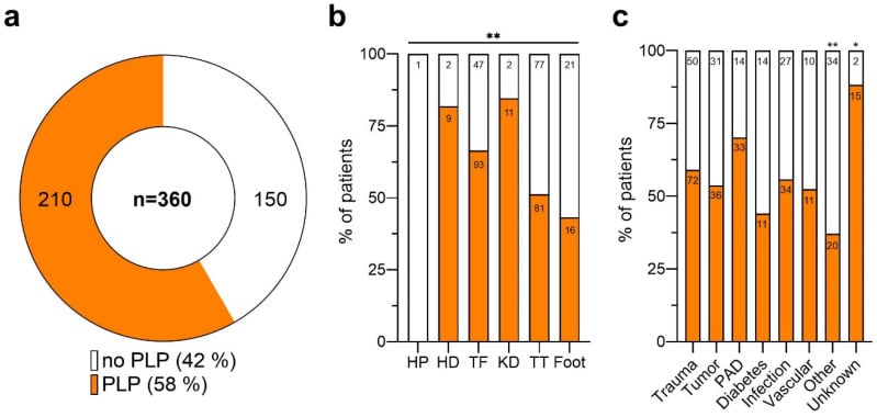 Charts showing phantom-limb pain prevalence and its distribution across lower-limb amputation levels.