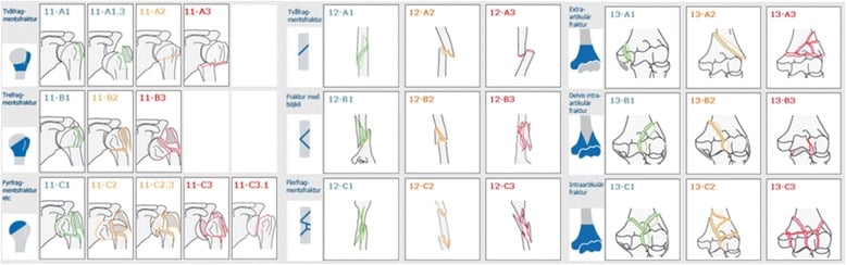 Schematic diagram of the AO/OTA classification system for humeral fractures