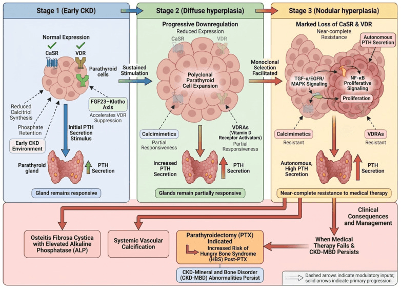 Diagram showing progression of secondary hyperparathyroidism from adaptive secretion to diffuse and nodular parathyroid hyperplasia
