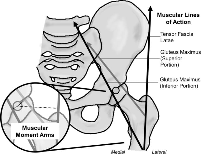 Pelvis and proximal femur diagram, labelled medial and lateral, showing tensor fascia latae and gluteus maximus lines of action with an inset of their moment arms