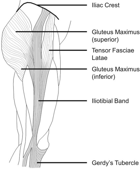 Labelled diagram of the iliotibial band from the iliac crest to Gerdy's tubercle, showing gluteus maximus and tensor fasciae latae contributions.