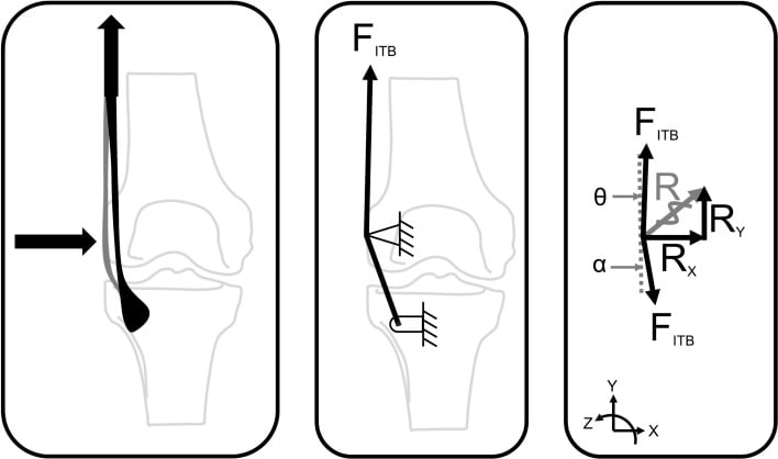 Three-panel free-body model of the distal iliotibial band, resolving band tension into a reaction force and its components