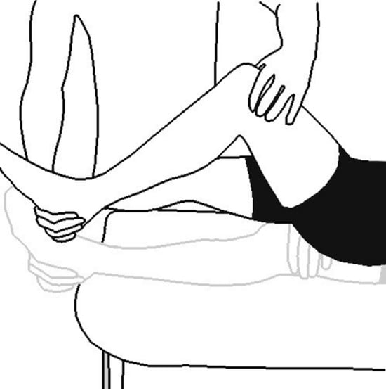 Illustration of the Noble compression test: examiner applies pressure over the lateral femoral epicondyle while extending the patient's knee from flexion.