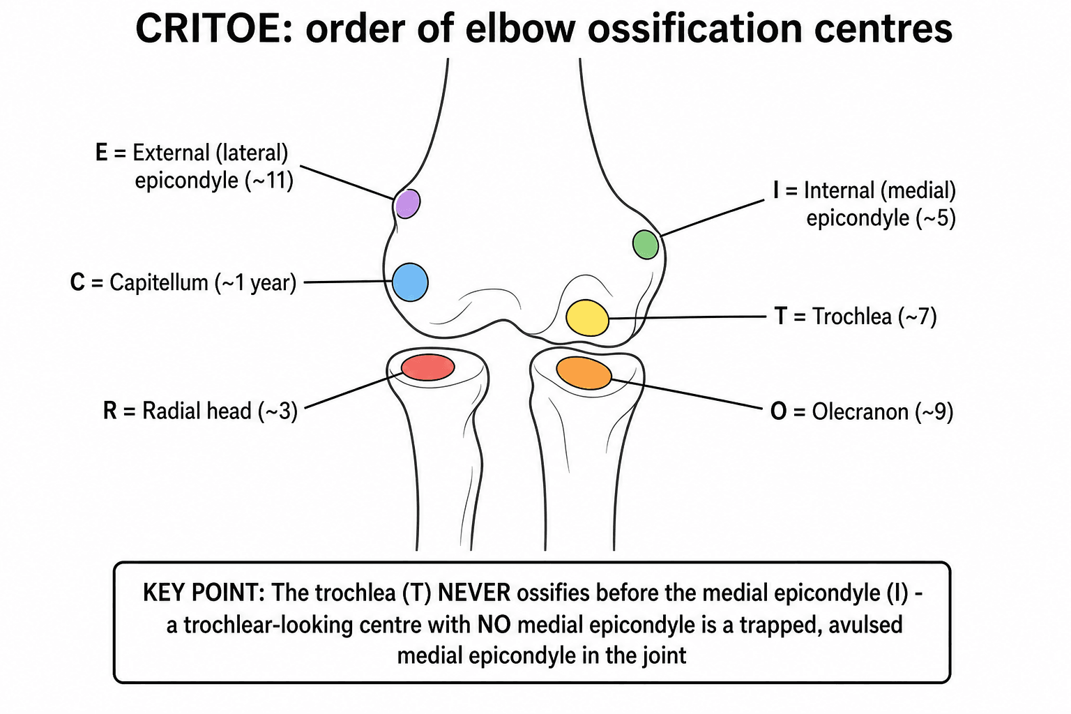 Schematic of the CRITOE order of elbow ossification centres with typical ages and the trapped medial epicondyle pitfall