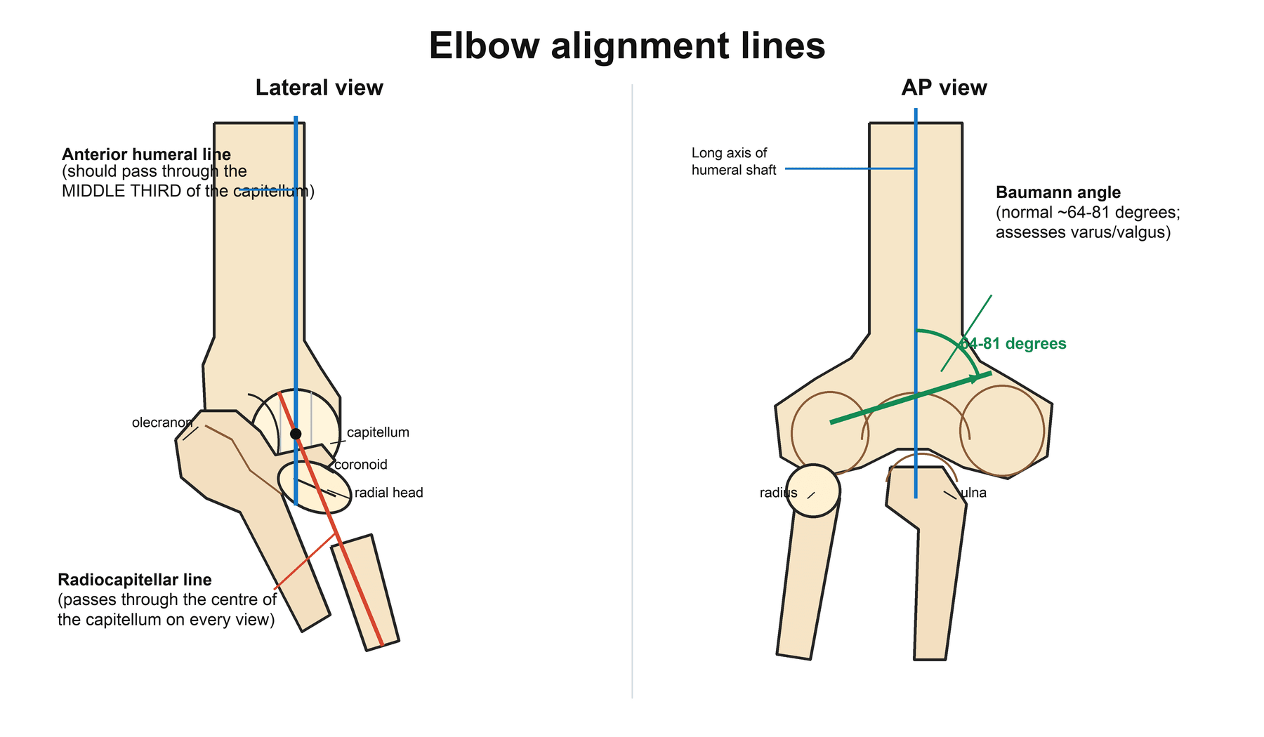 Schematic of elbow alignment lines: anterior humeral line and radiocapitellar line on the lateral view and Baumann angle on the AP view