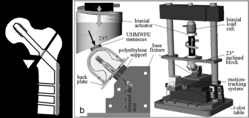 Biomechanical test model for lag-screw fixation of an unstable intertrochanteric fracture