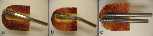 Lag screw failure modes in foam-bone test blocks: varus cut-out, screw bending and axial migration