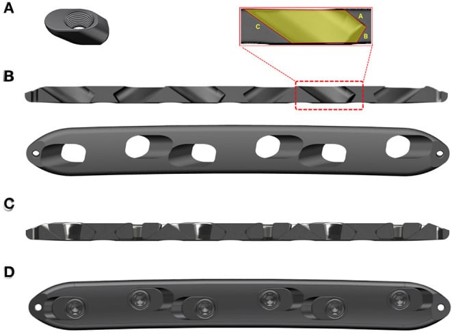 Design views of an axial-micromotion locking plate with sliding threaded wedges that permit controlled axial motion.