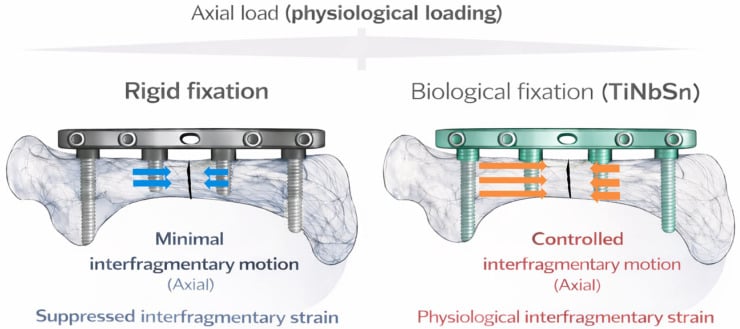 Conceptual comparison of a conventional rigid plate with a low-modulus biological plate showing minimal versus controlled interfragmentary motion.