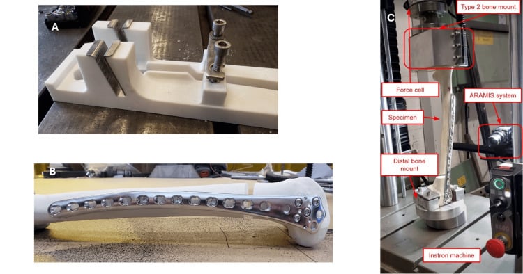 Distal-femoral bridge-plate model showing a standardised ten-millimetre fracture gap, alternate working lengths and cyclic axial test setup.