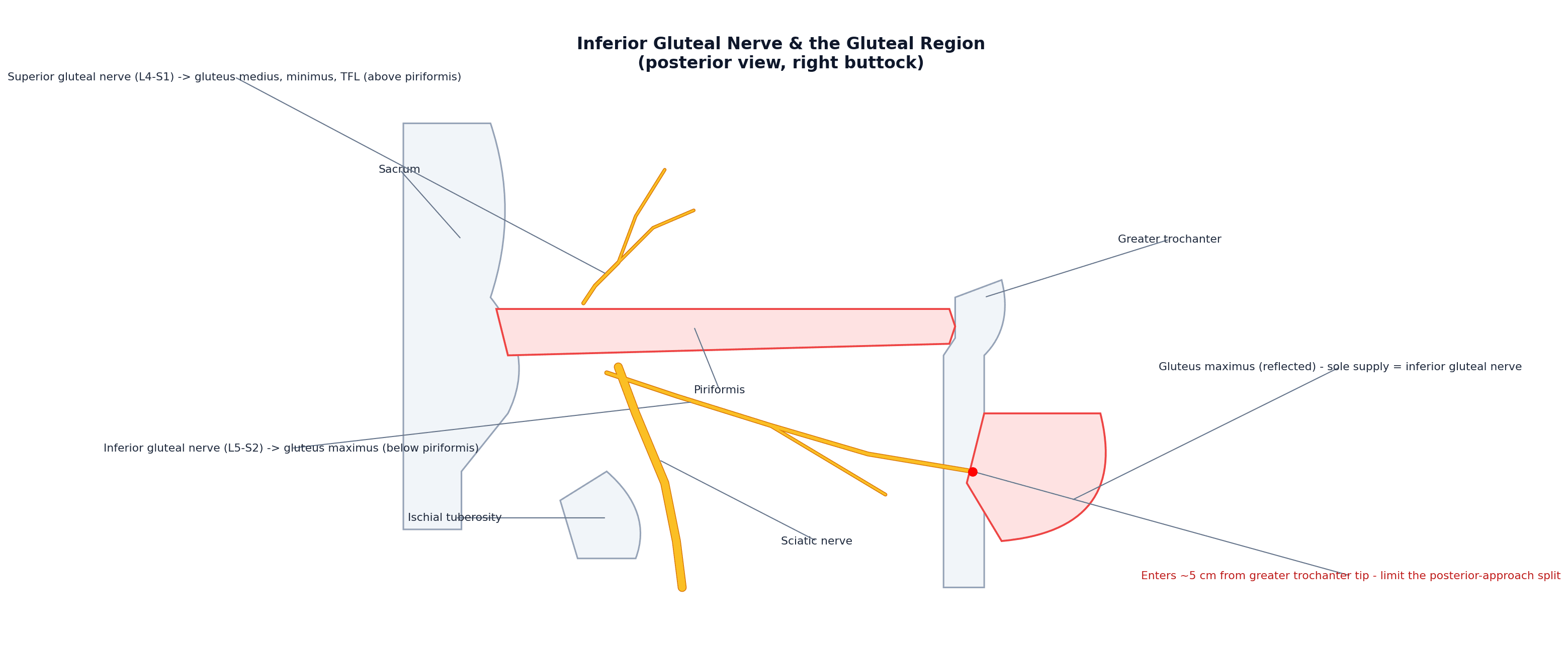 Posterior view of the right gluteal region showing the superior gluteal nerve above piriformis and the inferior gluteal nerve and sciatic nerve below piriformis, with the inferior gluteal nerve entering the reflected gluteus maximus