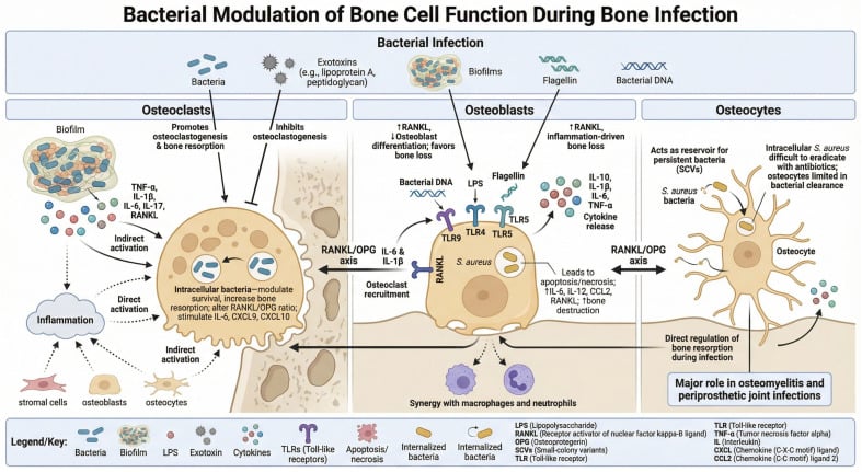 Osteoimmune effects of bacterial bone infection