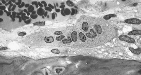 Histology of a single large multinucleated osteoclast lying against a bone surface