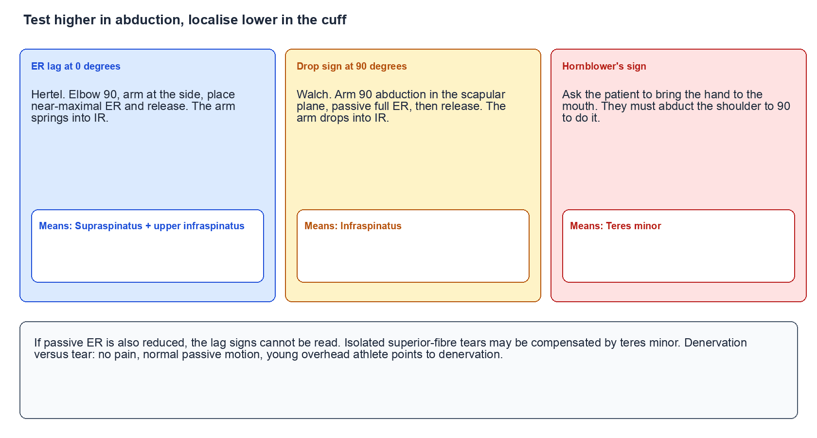 Three-panel examination map: ER lag at 0 degrees, drop sign at 90 degrees, and hornblower sign, localising progressively lower in the posterior cuff