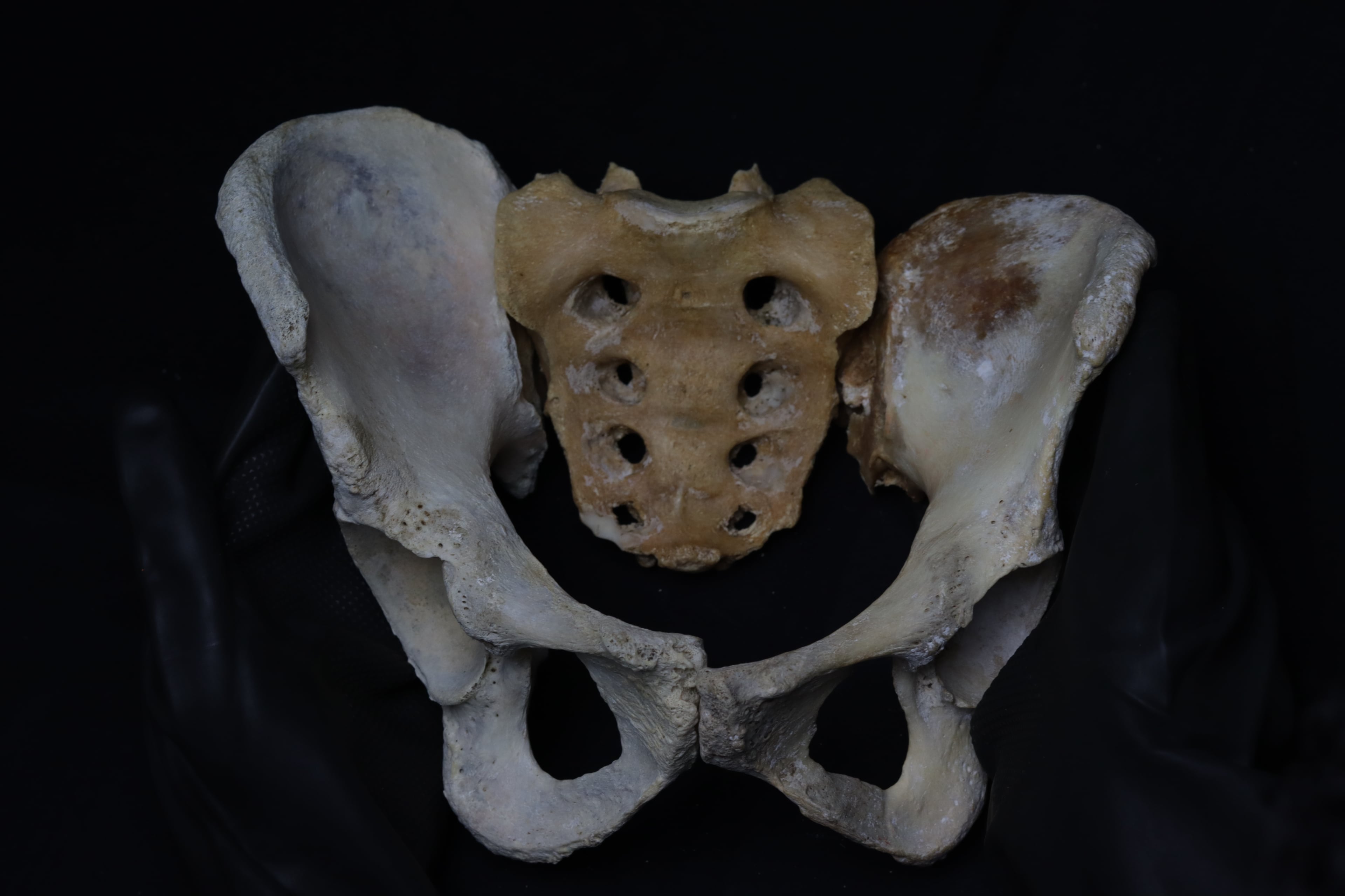 Photograph of an articulated dry human pelvis specimen showing both innominate bones and the sacrum.