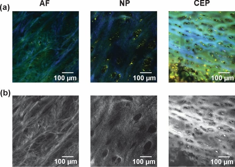 Multiphoton microscopy comparing annulus fibrosus, nucleus pulposus and cartilage endplate extracellular matrix